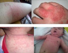 專業(yè)除醛師全方位解讀如何真正去除室內甲醛